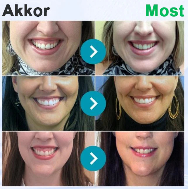 Furzero® 𝑭𝒐𝒄𝒖𝒔𝒔𝒎𝒊𝒍𝒆 – Méhméreges szájápoló por 🦷🦷