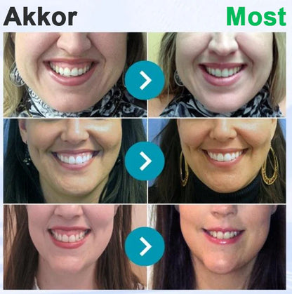 Furzero® 𝑭𝒐𝒄𝒖𝒔𝒔𝒎𝒊𝒍𝒆 – Méhméreges szájápoló por 🦷🦷