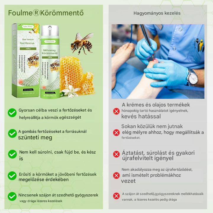 Korlátozott ideig 50%-os kedvezmény | Foulme® NailRescue Méhméreg Spray🐝