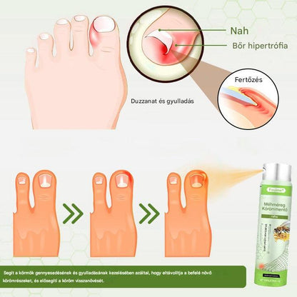 Korlátozott ideig 50%-os kedvezmény | Foulme® NailRescue Méhméreg Spray🐝